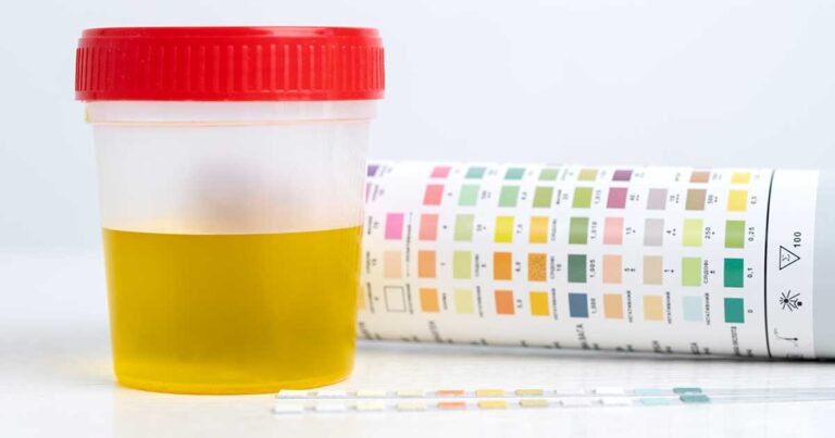 How to Pass a Drug Test: Tips and Tricks for Success